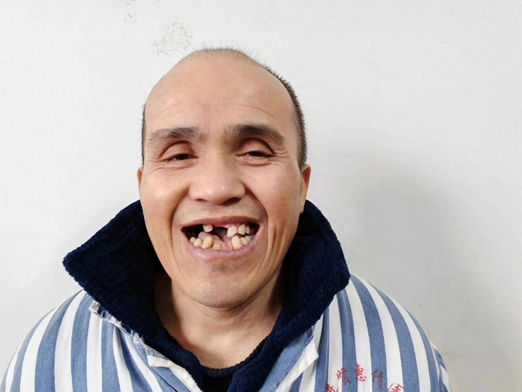 走失者照片 南昌市寻亲：五旬男子被救助多年，自...