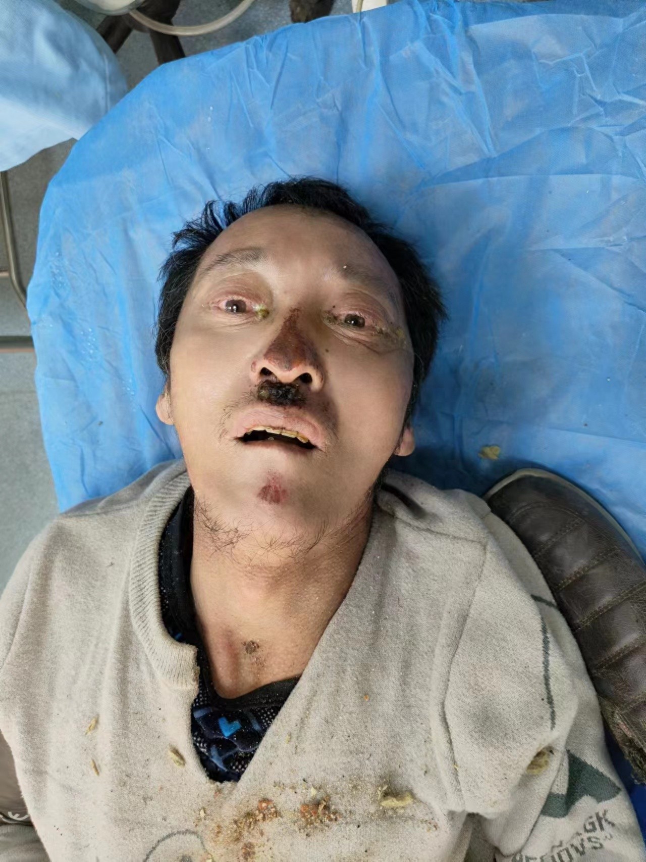 走失者照片 大连市寻亲：五旬男子被救助，高约1...