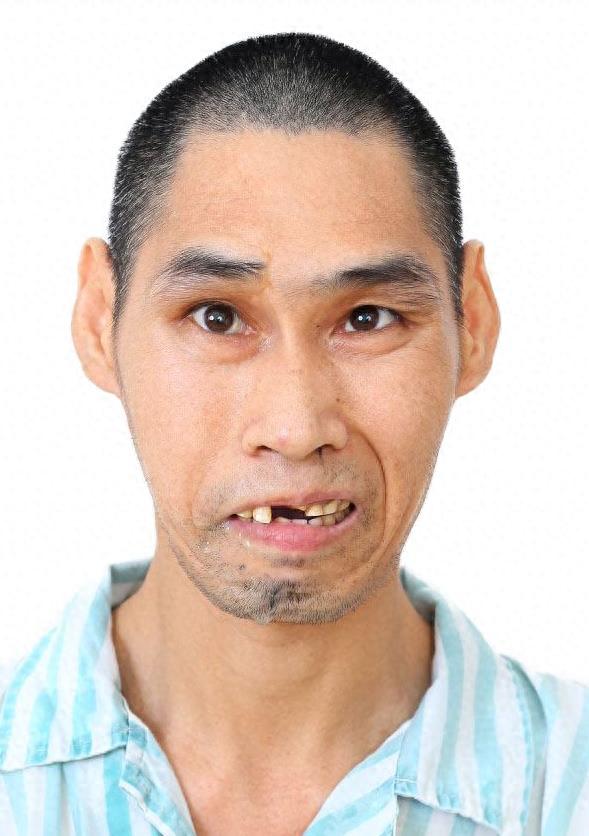 走失者照片 佛山市寻亲：中年男子被救助多年，疑...