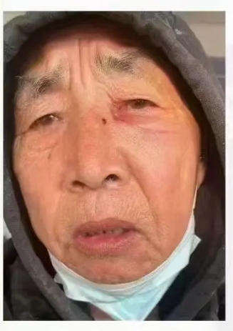 走失者照片 漯河市急寻：七旬老人走失，患小脑萎...