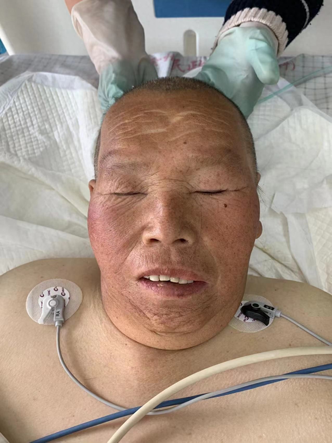 走失者照片 徐州市寻亲：六旬老人被救助，高1米...