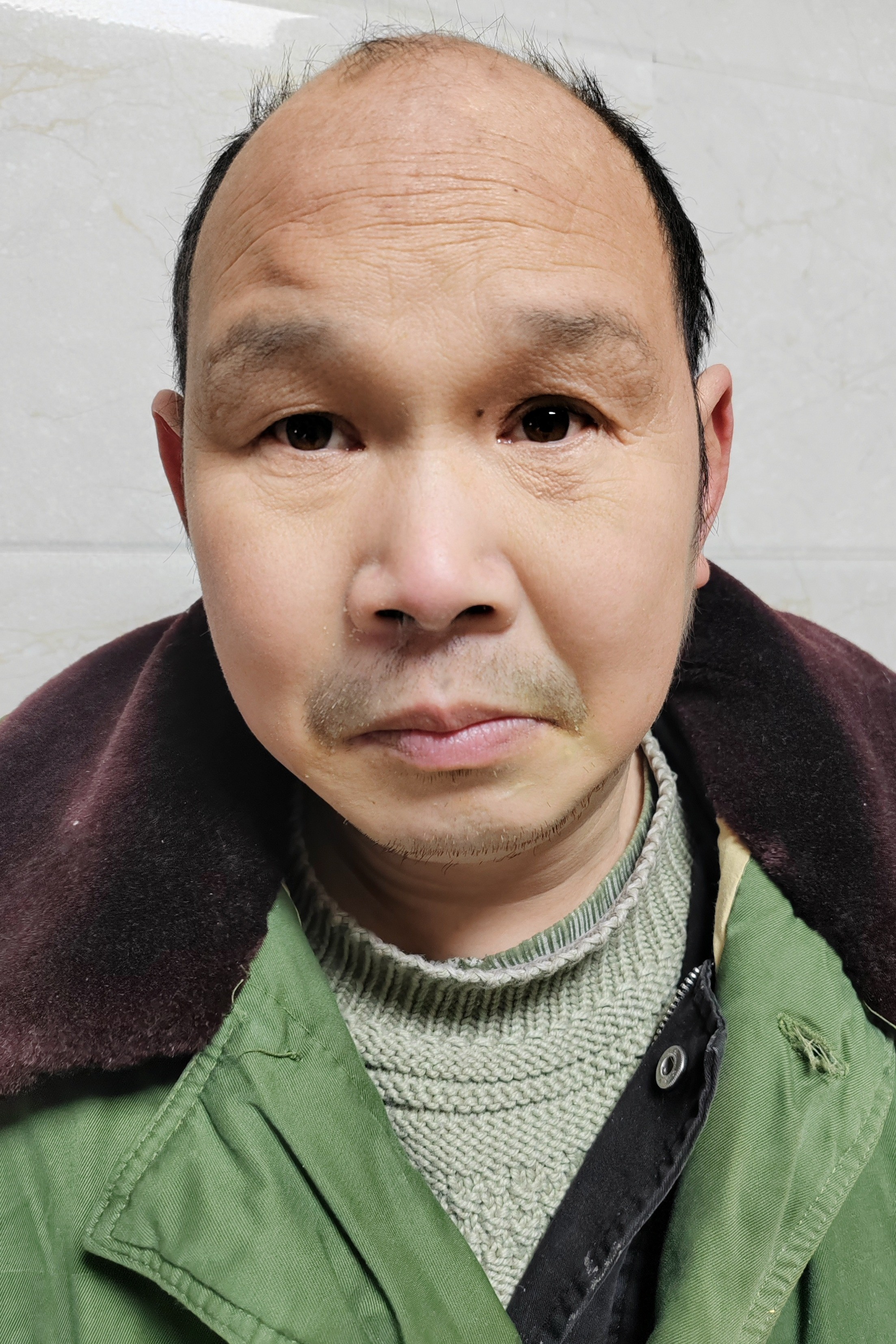 走失者照片 湖北省神农架林区寻亲：六旬老人被救...