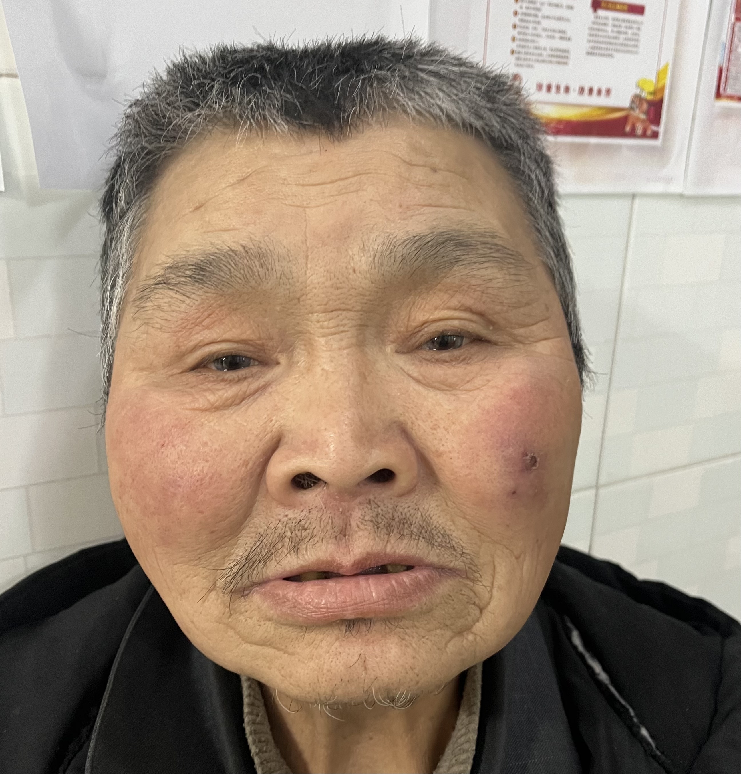 走失者照片 西安市寻亲：五旬男子被救助，穿黑色...