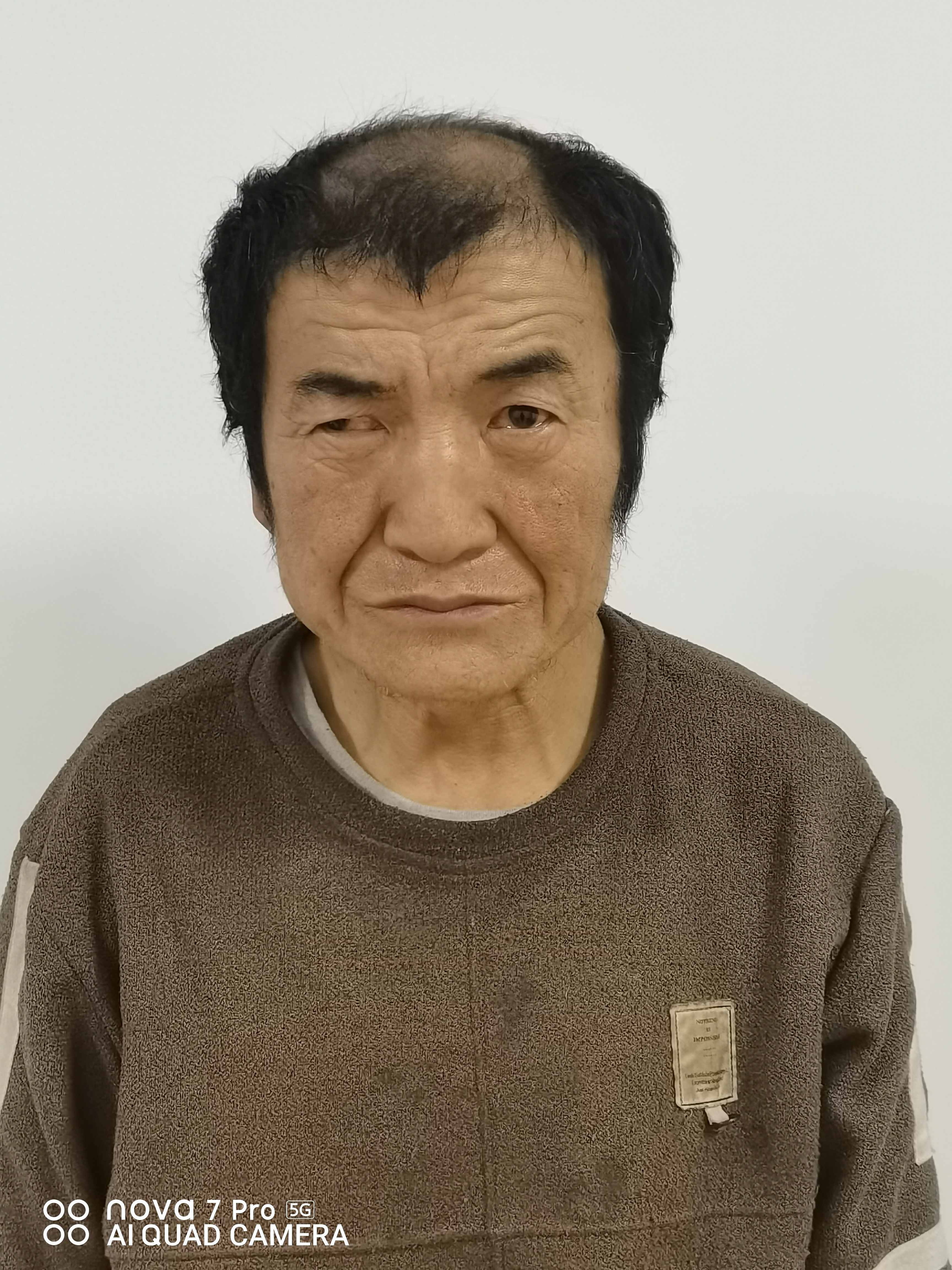 走失者照片 石嘴山市寻亲：五旬男子被救助，名叫...