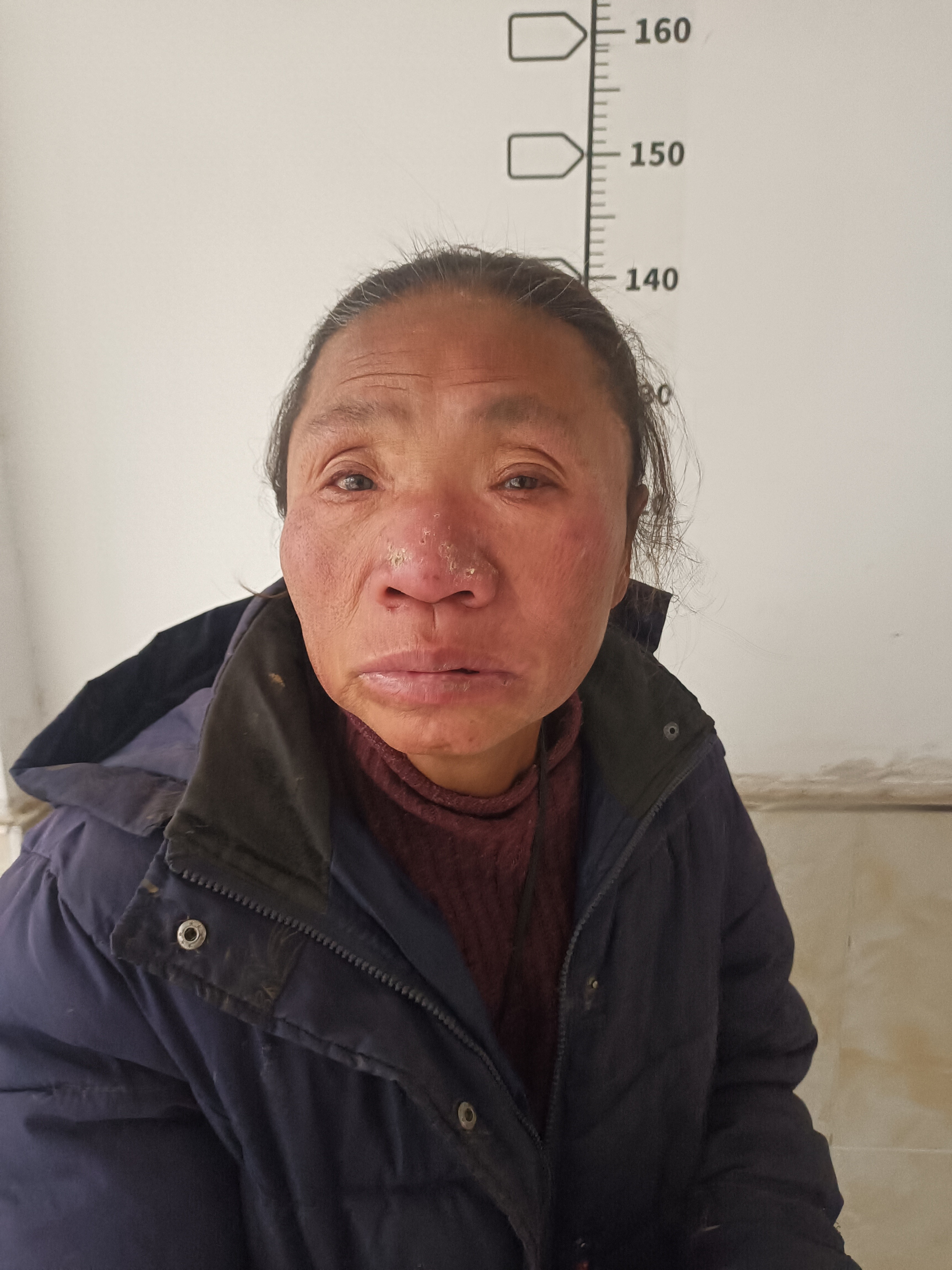 走失者照片 阜阳市寻亲：五旬女子被救助，穿深蓝...