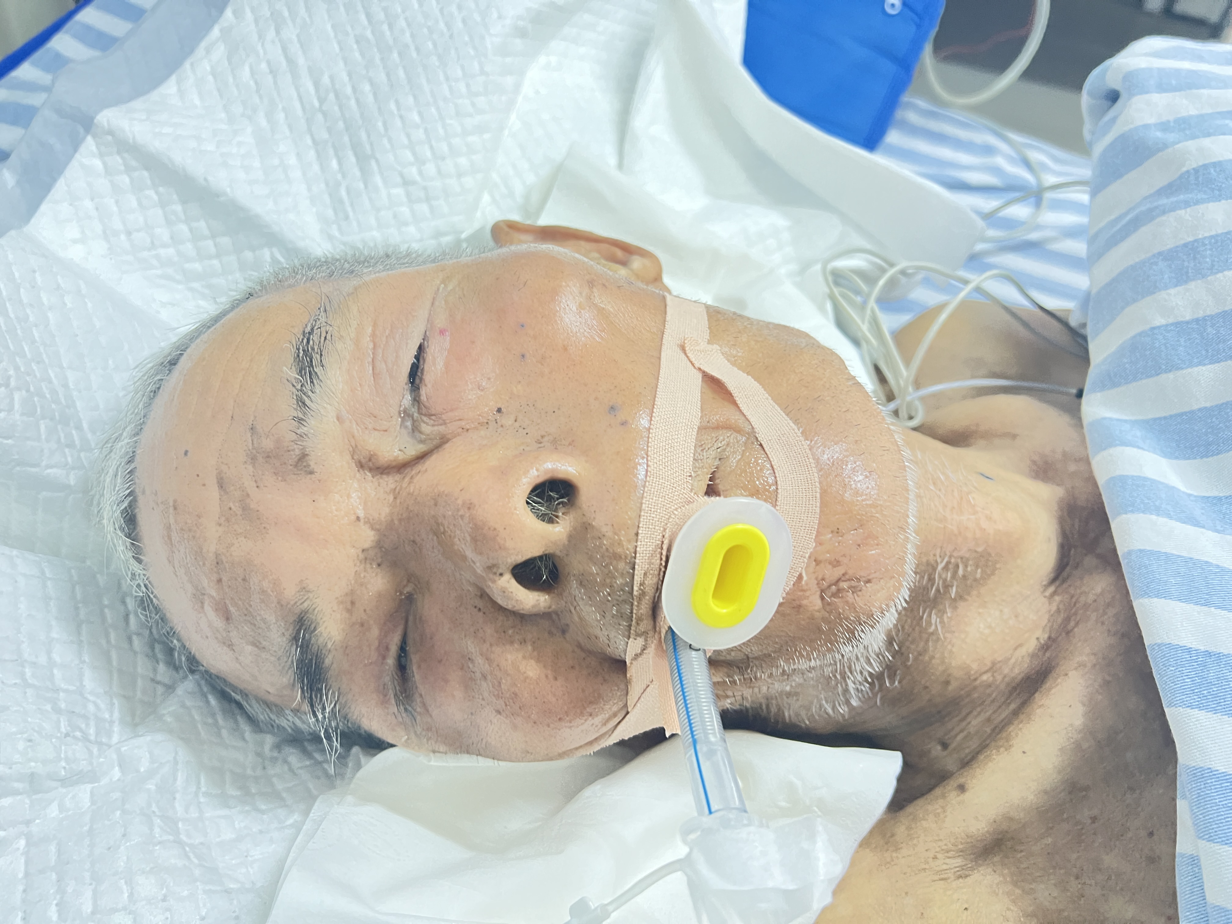 走失者照片 宜春市寻亲：七旬老人被送医，自述叫...
