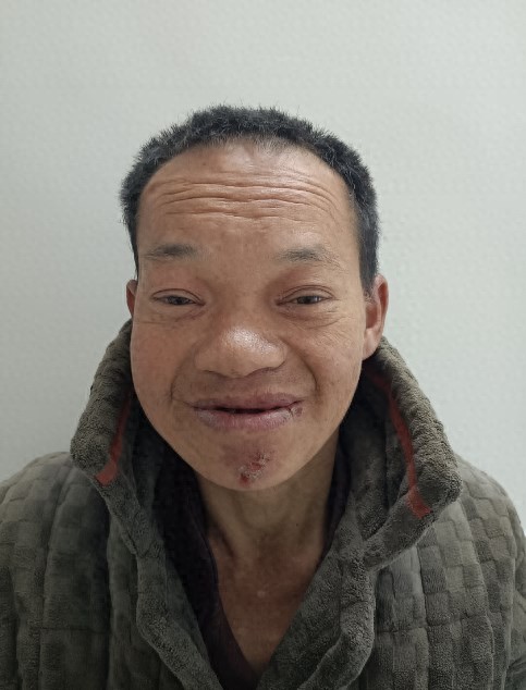走失者照片 邵阳市寻亲：五旬男子被救助，高1米...