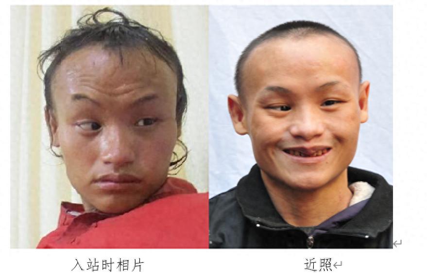 走失者照片 汕头市寻亲：青年男子被救助多年，高...