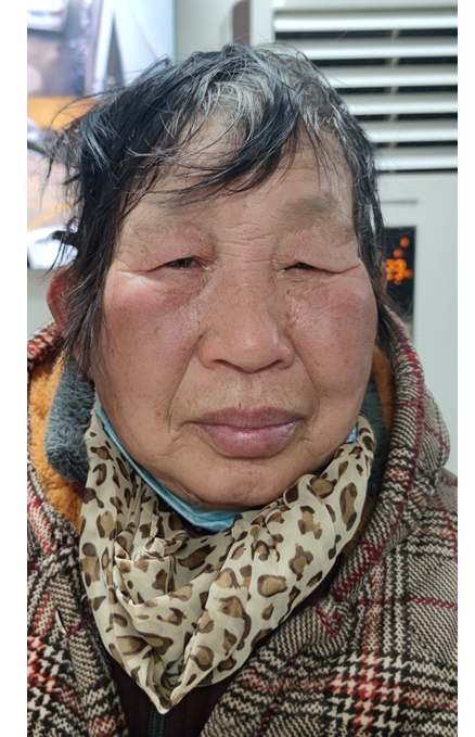 走失者照片 聊城市寻亲：六旬老太被救助，穿方格...