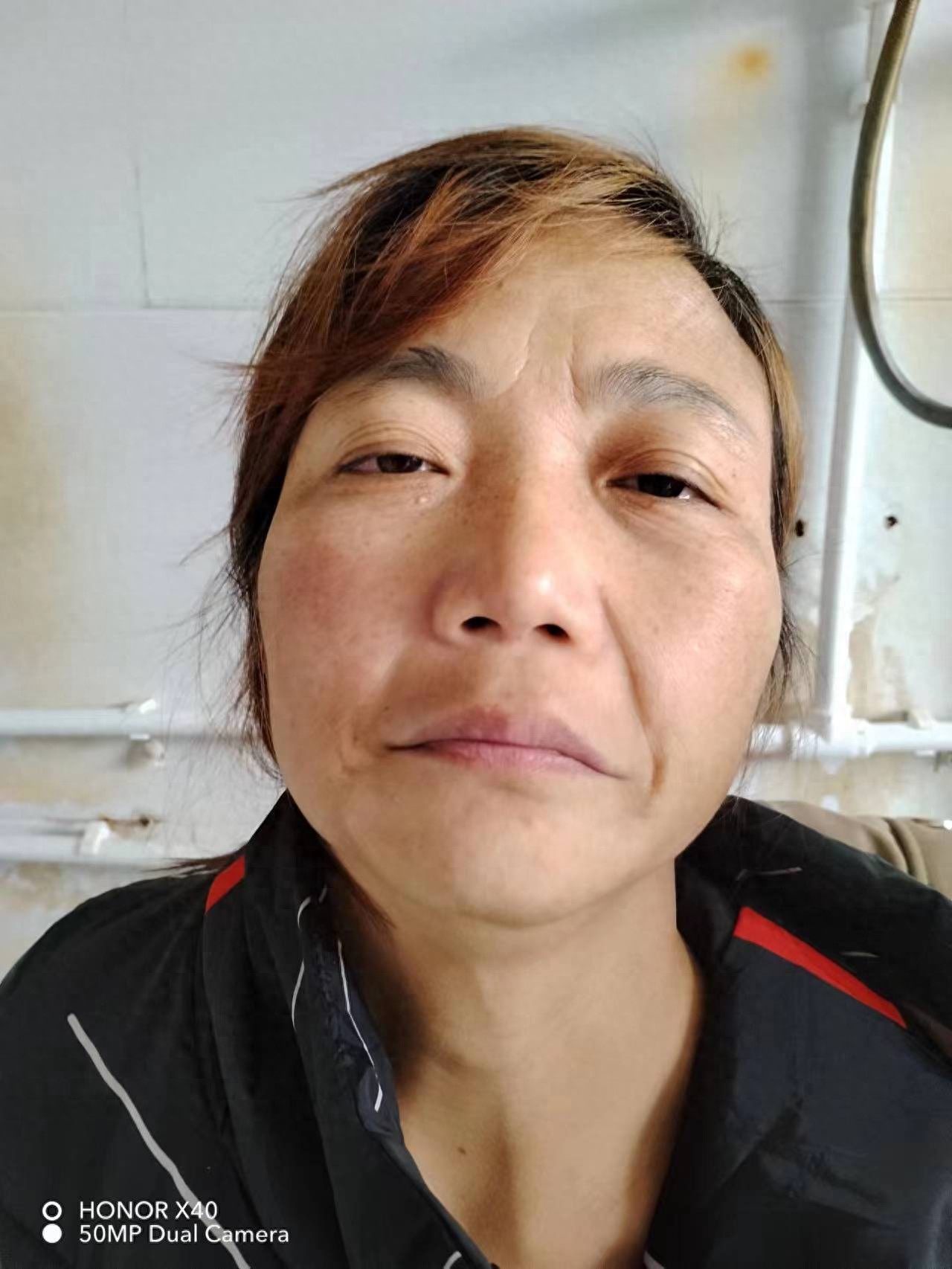 走失者照片 周口市项城市寻亲：中年女子被救助，...