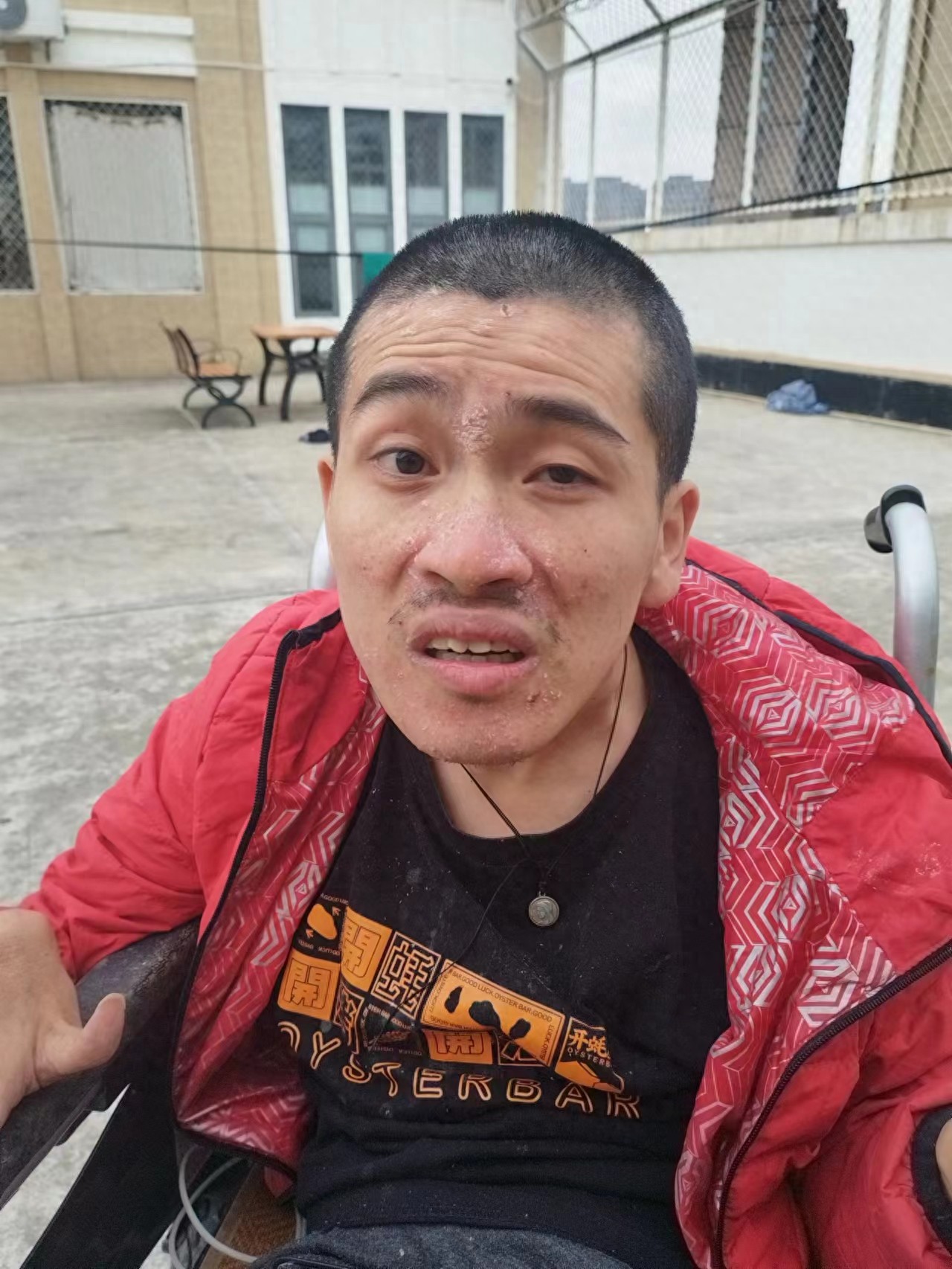 走失者照片 福州市福清市寻亲：青年男子被救助多...