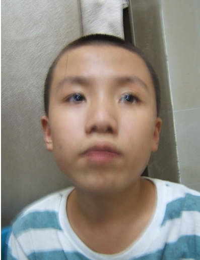 走失者照片 汕头市寻亲：青年男子被救助多年，智...