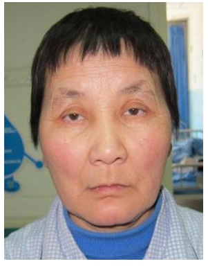 走失者照片 乌鲁木齐市寻亲：五旬女子被救助，自...