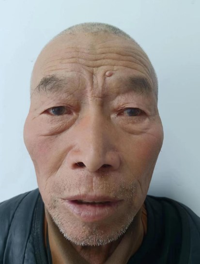 走失者照片 沈阳市寻亲：六旬老人被救助，自述叫...