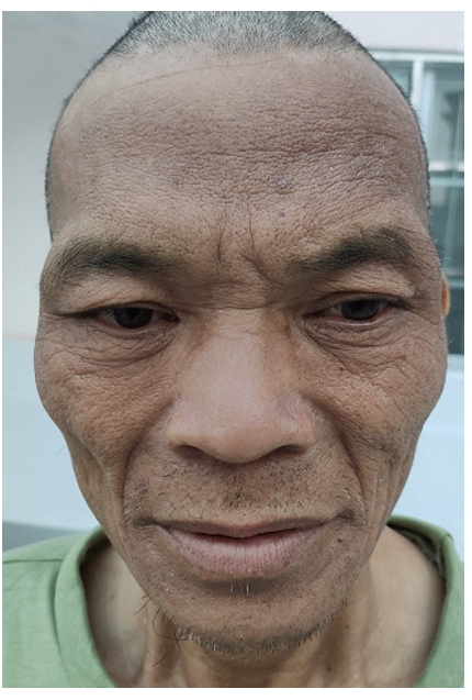 走失者照片 桂林市寻亲：六旬老人被救助，穿黑色...