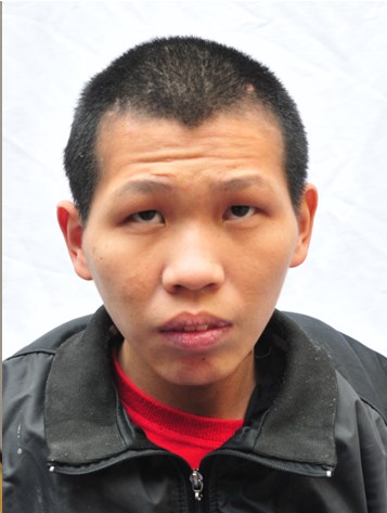 走失者照片 汕头市寻亲：青年男子被长期救助，智...