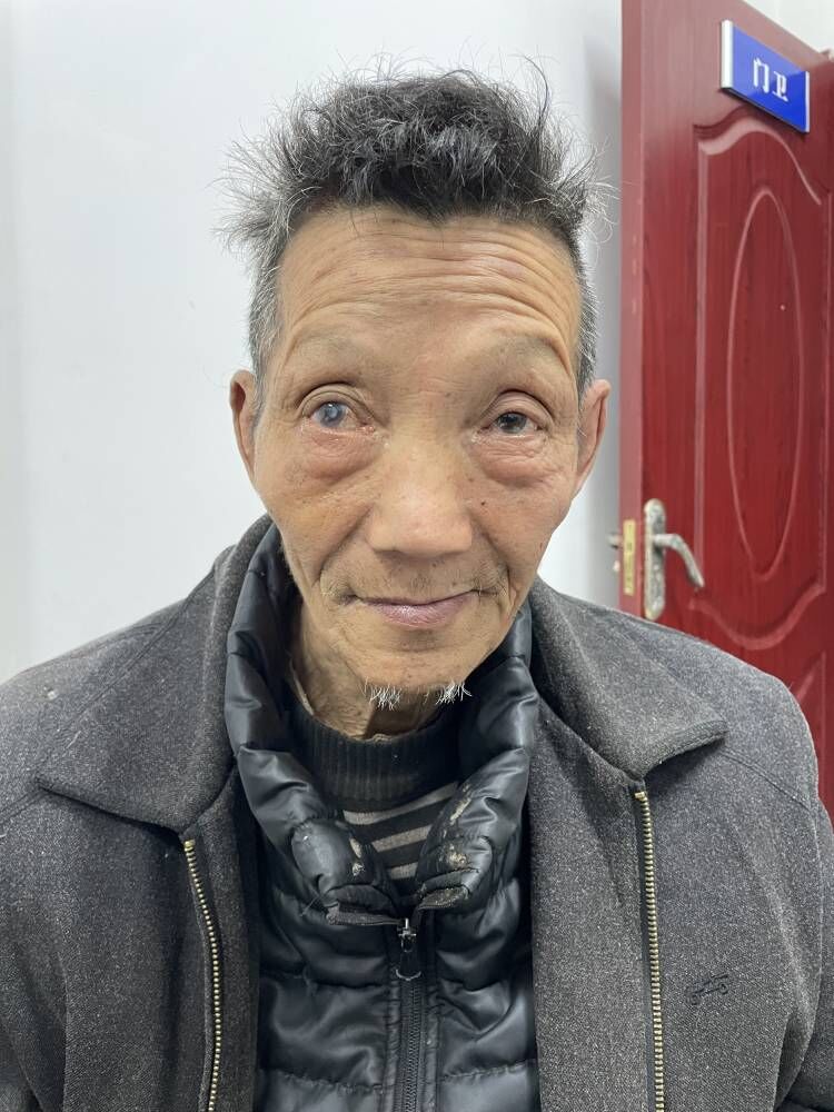 走失者照片 安康市寻亲：七旬老人被救助，右眼患...