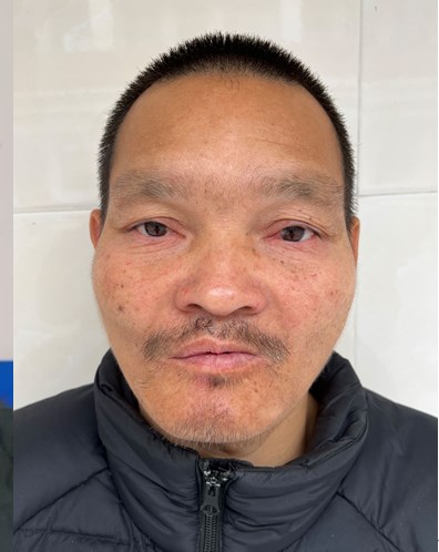 走失者照片 汕头市寻亲：中年男子被救助，疑似揭...