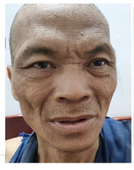 走失者照片 桂林市寻亲：六旬老人被救助，穿黑色...