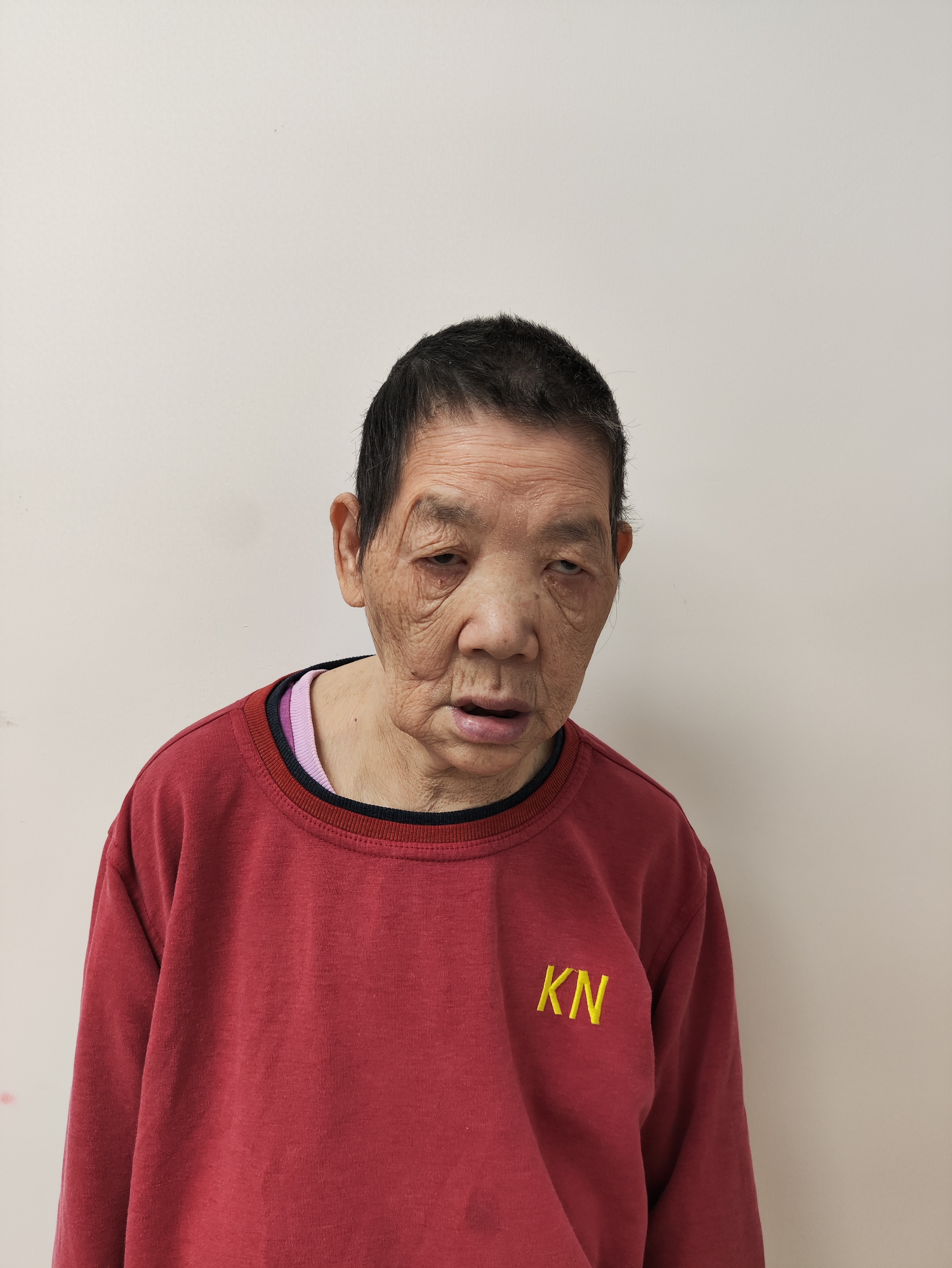 走失者照片 深圳市寻亲：六旬老太被救助，精神异...