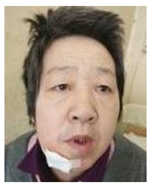 走失者照片 乌鲁木齐市寻亲：六旬老太被救助，自...