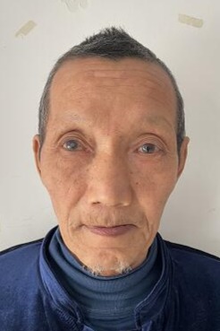走失者照片 安康市寻亲：七旬老人被救助，右眼患...