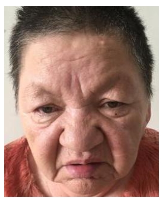 走失者照片 乌鲁木齐市寻亲：六旬老太被救助多年...