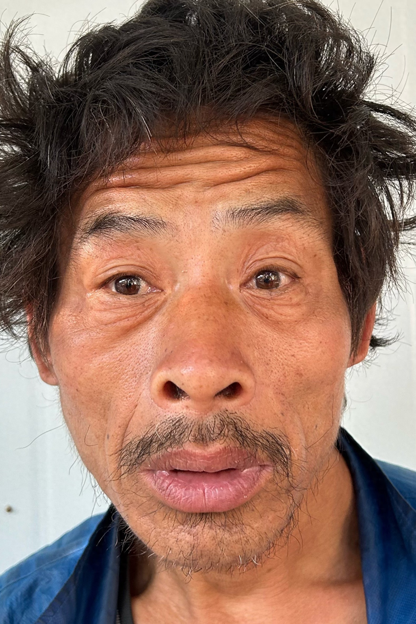 走失者照片 福州市六旬老人被救助，穿蓝色外套、...