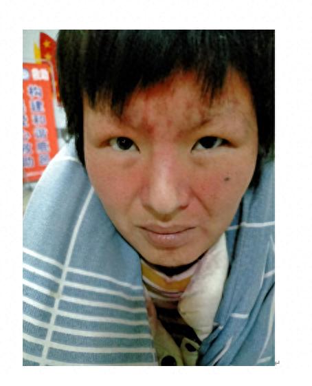 走失者照片 周口市寻亲：中年女子被救助，精神异...