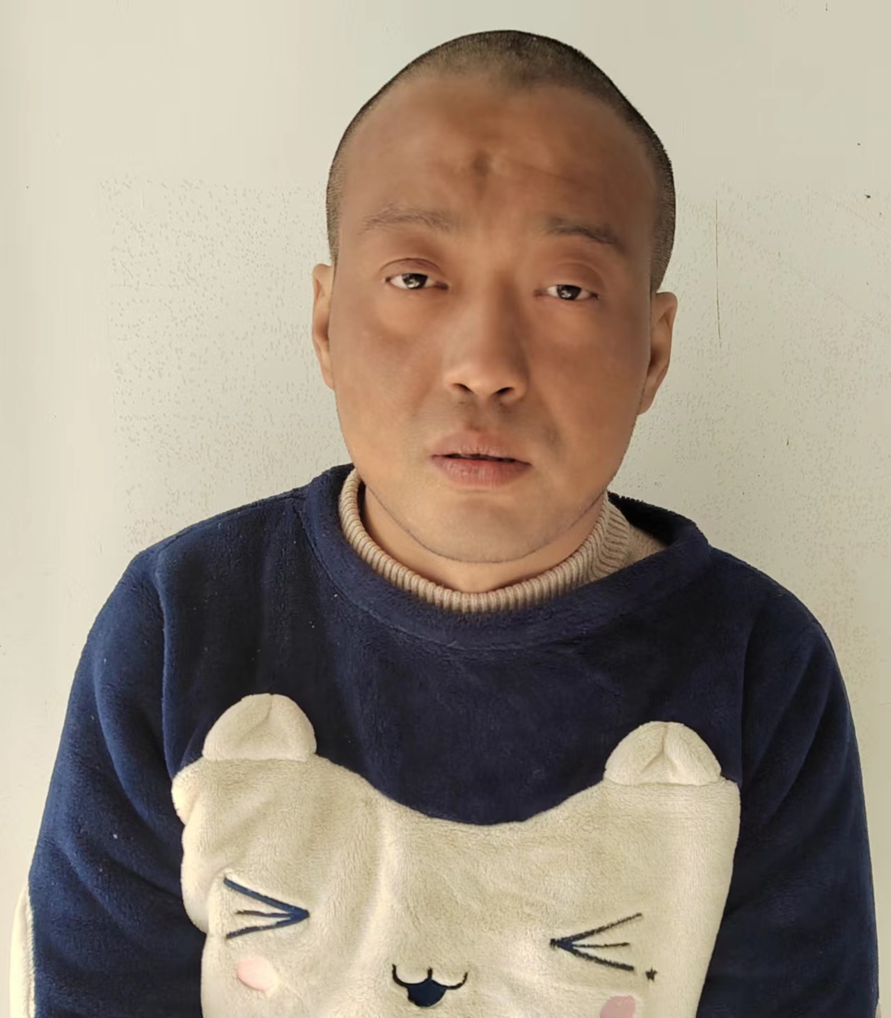 走失者照片 孝感市寻亲：中年男子被救助，高1米...