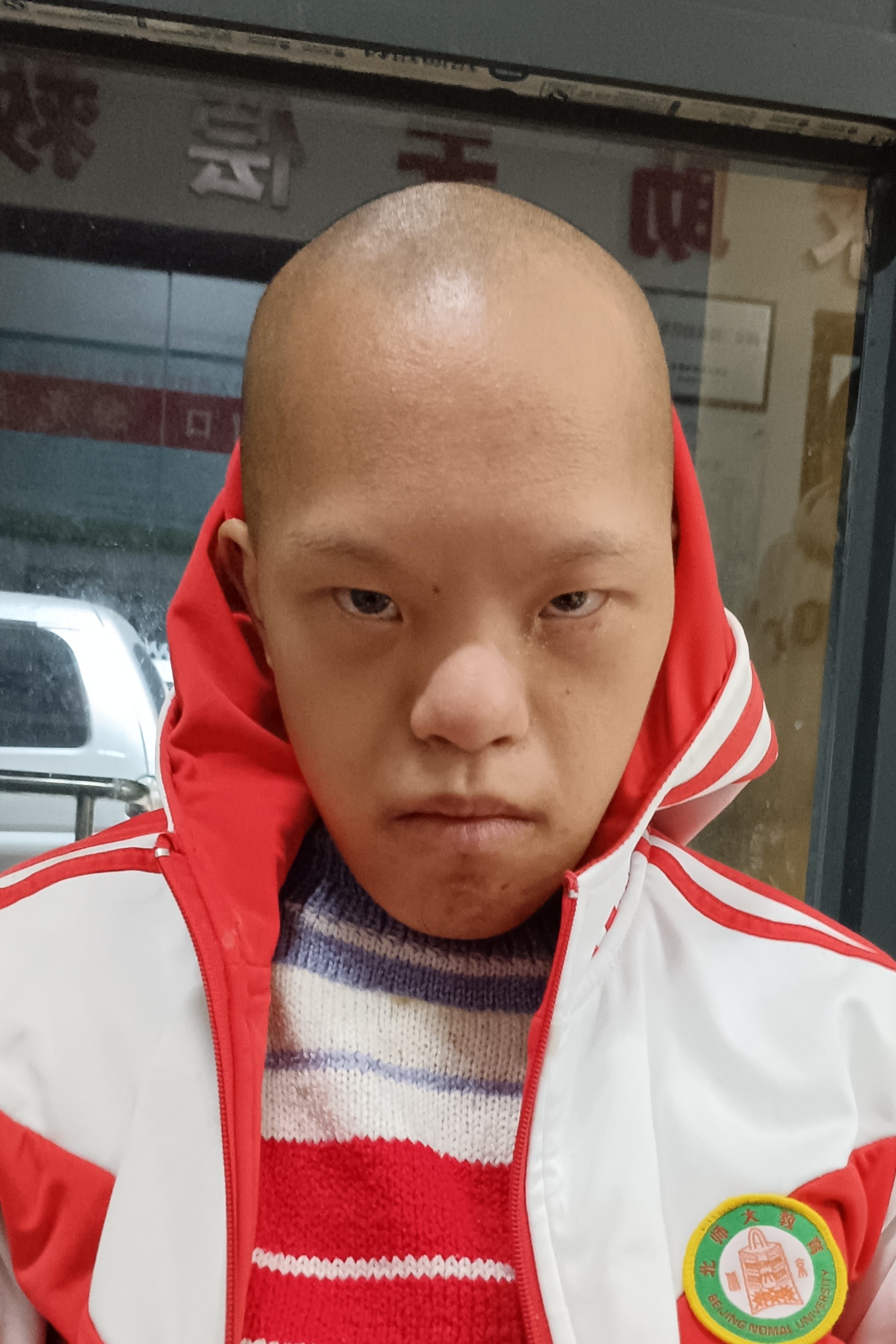 走失者照片 钦州市寻亲：18岁男子被救助，高1...
