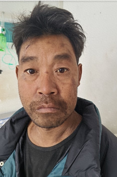 走失者照片 楚雄州楚雄市寻亲：青年男子被救助，...