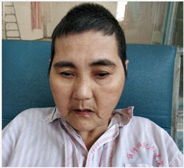 走失者照片 澳门寻亲：中年女子在佛山市被救助，...