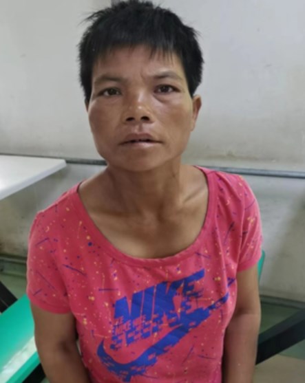 走失者照片 阳泉市寻亲：中年女子在保定市被救助...