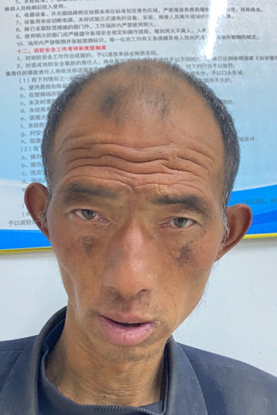 走失者照片 帮他回家：六安市五旬男子被救助，高...