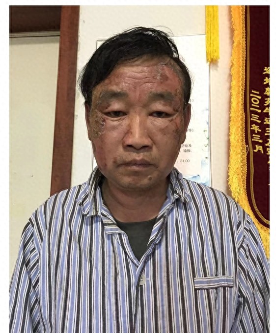 走失者照片 济南市寻亲：五旬男子被救助，穿黑色...