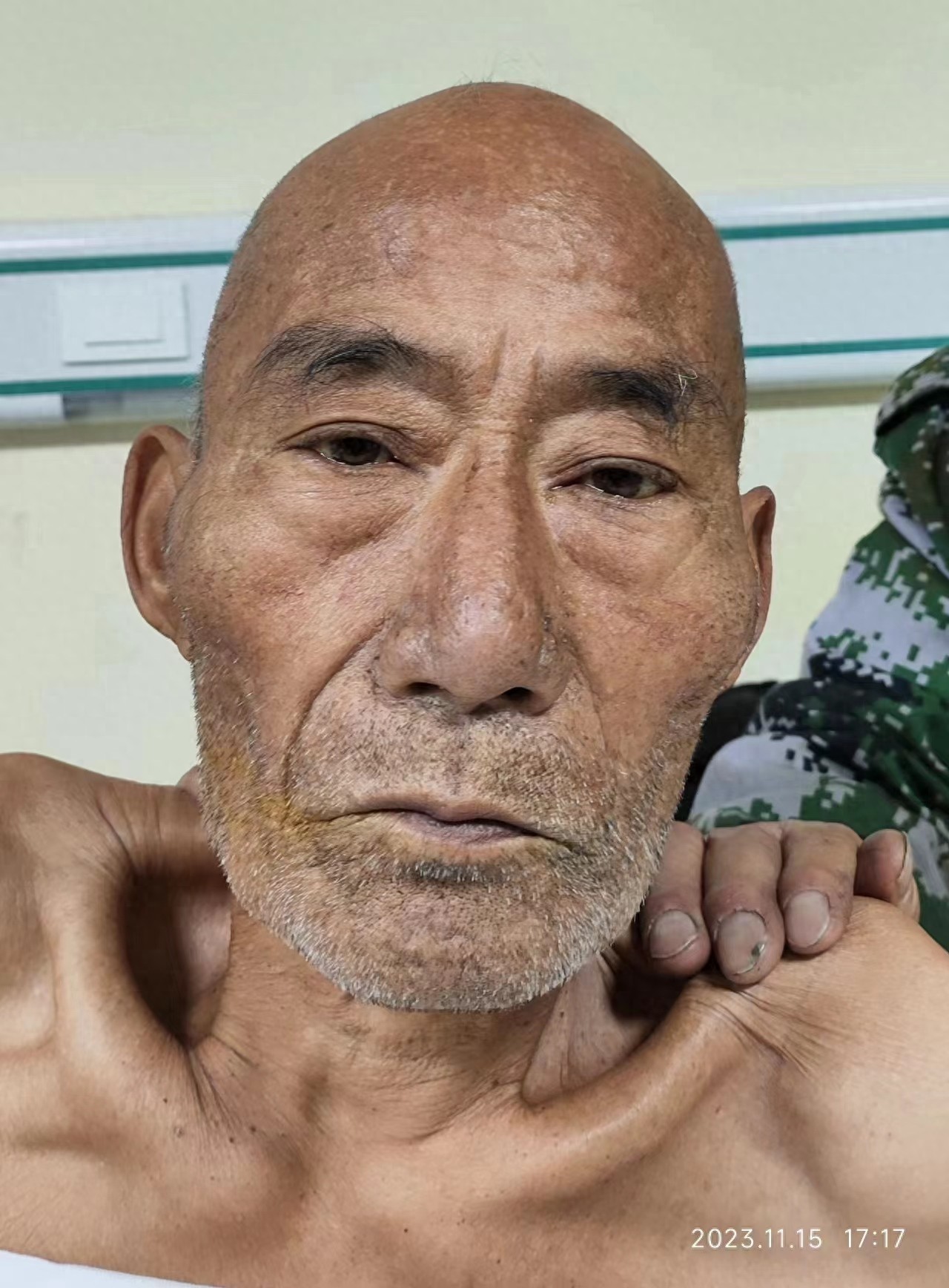 走失者照片 大庆市寻亲：六旬老人被救助，自述叫...