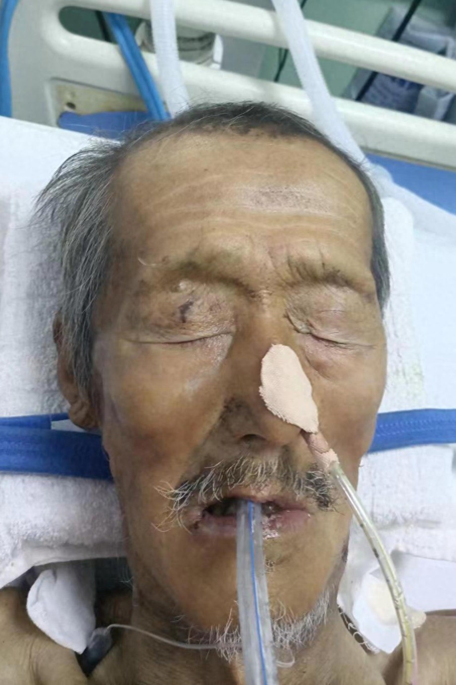 走失者照片 鞍山市寻亲：七旬老人被救助，高1米...