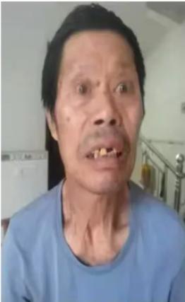 走失者照片 抚州市寻人：七旬老人走失，穿迷彩服...