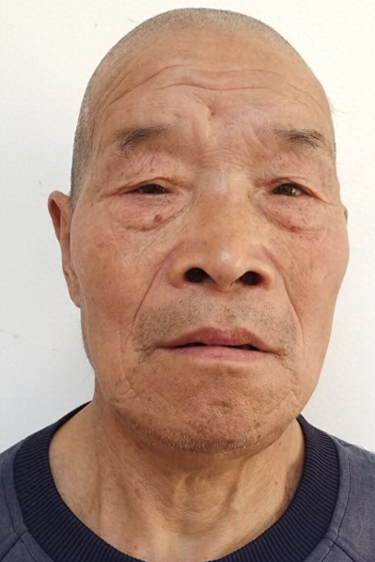 走失者照片 湖北省神农架林区寻亲：六旬老人被救...