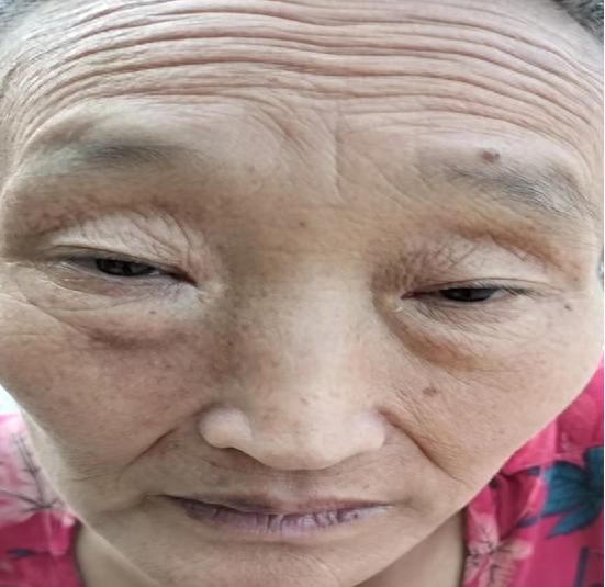走失者照片 商丘市永城市寻亲：六旬老太被救助，...