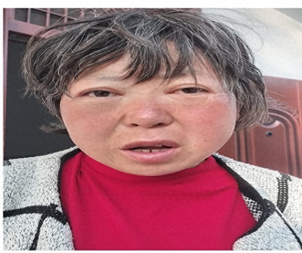 走失者照片 商丘市永城市寻亲：五旬女子被救助，...