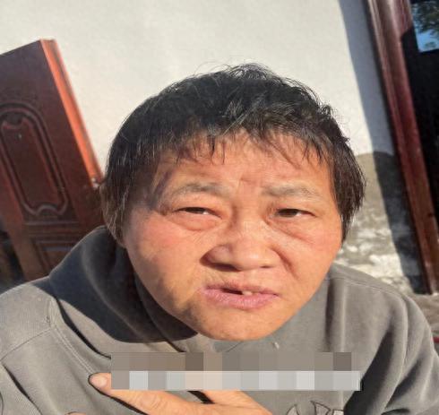 走失者照片 商丘市永城市寻亲：中年女子被救助，...
