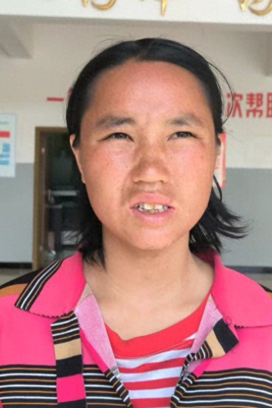 走失者照片 昭通市寻亲：青年女子被救助，自述叫...