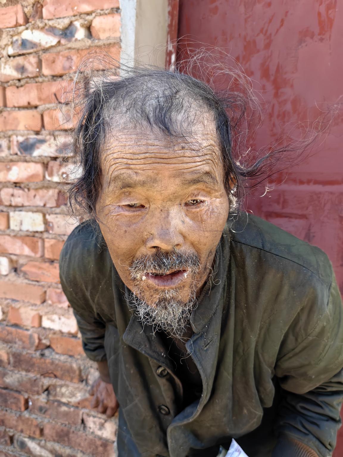走失者照片 昆明市寻亲：八旬老人被救助，自述叫...
