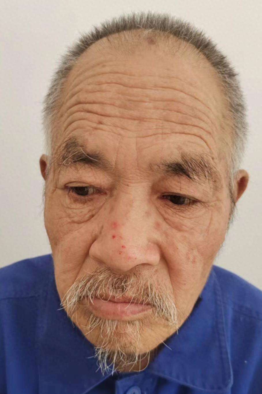 走失者照片 湖北省神农架林区寻亲：六旬老人被救...