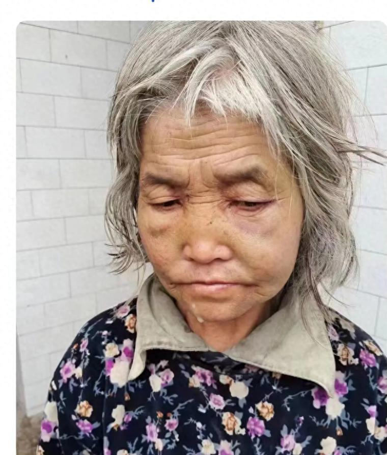 走失者照片 咸阳市寻人：六旬老太走失，精神异常...