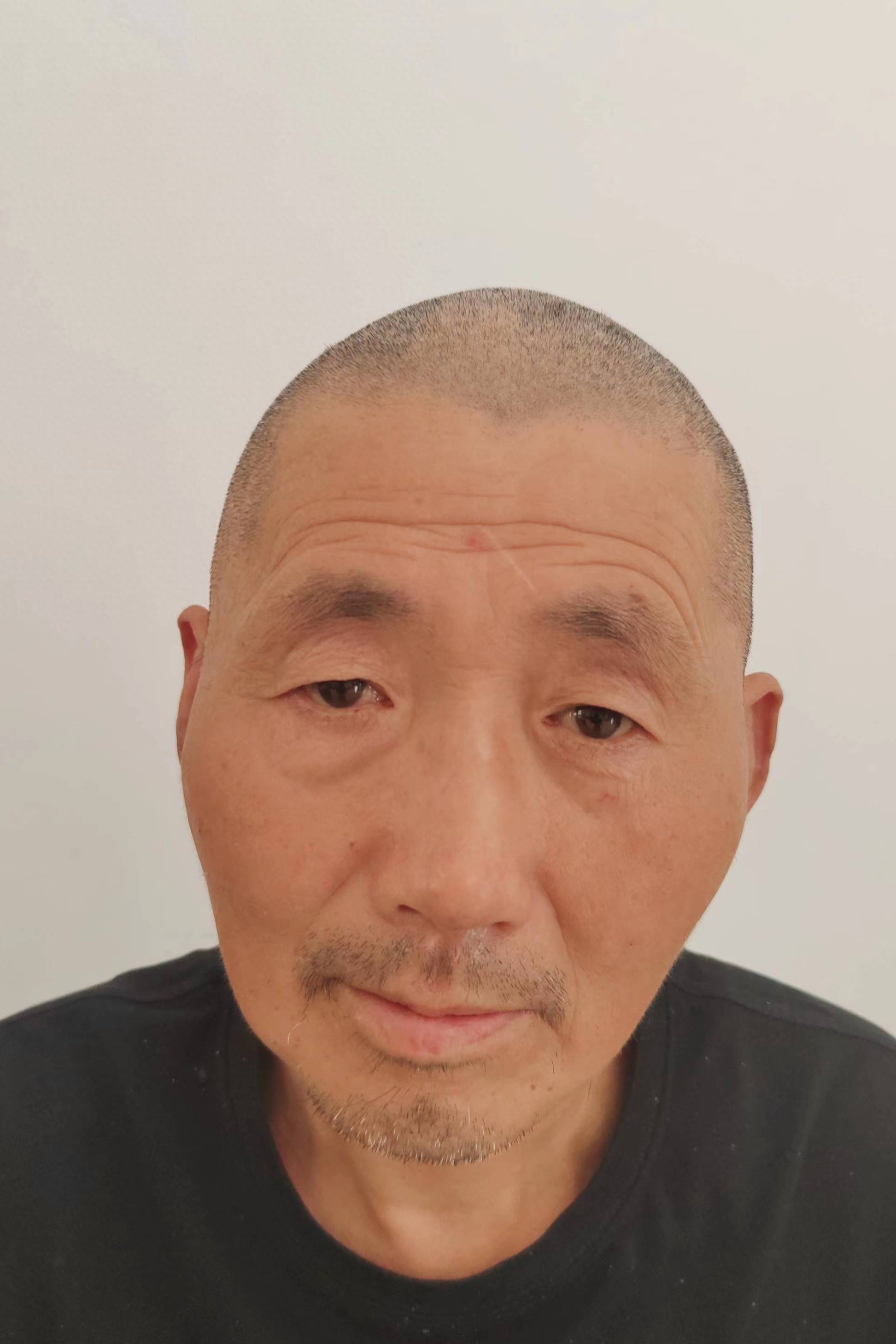 走失者照片 湖北省神农架林区寻亲：六旬老人被救...