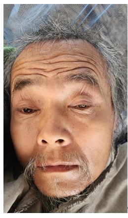 走失者照片 泰安市肥城市寻亲：七旬老人被救助，...
