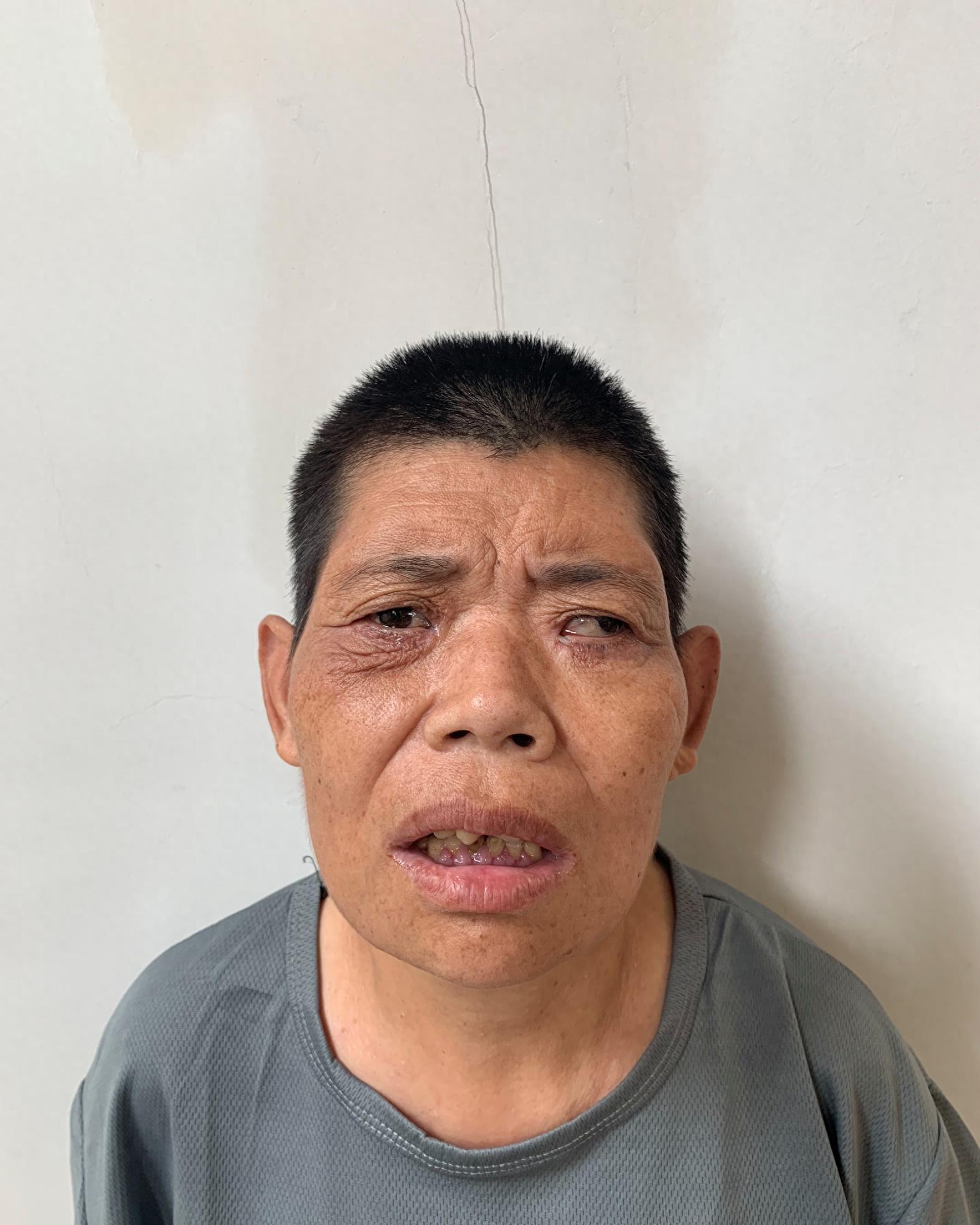 走失者照片 济南市中年女子被救助，高1米5，左...